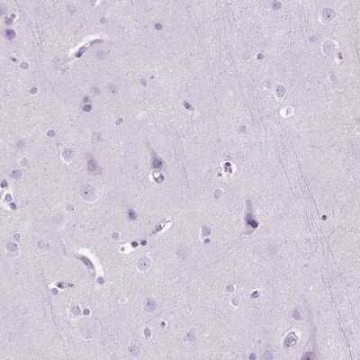Immunohistochemistry-Paraffin: Neprilysin/CD10 Antibody [NBP2-48701]