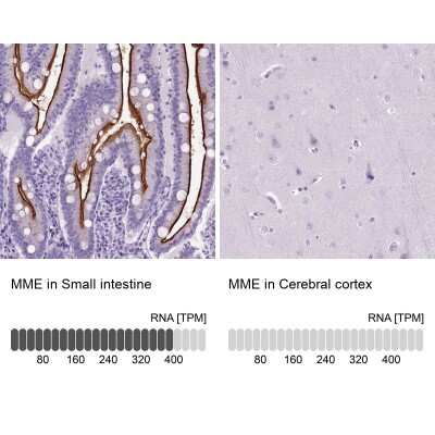 Immunohistochemistry-Paraffin: Neprilysin/CD10 Antibody [NBP2-48701]
