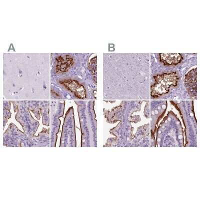 Immunohistochemistry-Paraffin: Neprilysin/CD10 Antibody [NBP2-48701]