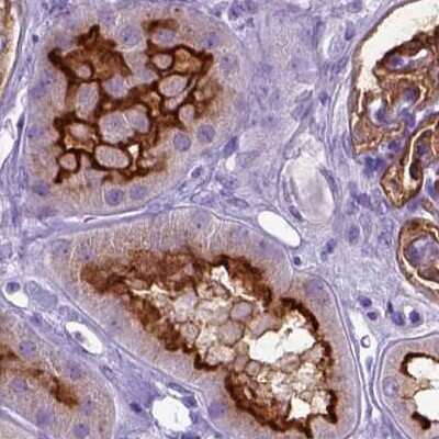 Immunohistochemistry-Paraffin: Neprilysin/CD10 Antibody [NBP2-48701]