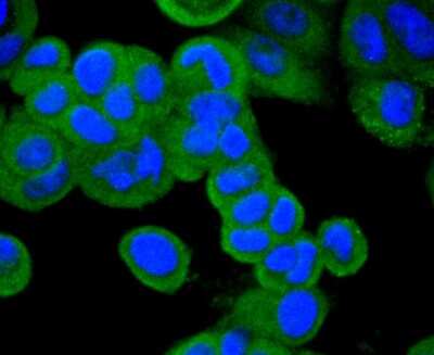 Immunocytochemistry/ Immunofluorescence: Neprilysin/CD10 Antibody (SN75-07) [NBP2-67717]