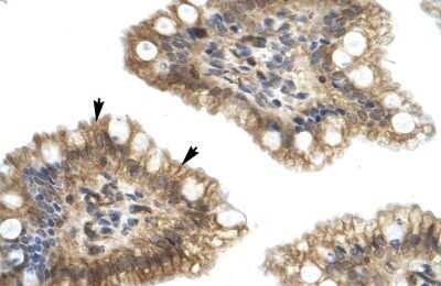 Immunohistochemistry: Nesfatin-1/Nucleobindin-2 Antibody [NBP1-57952]