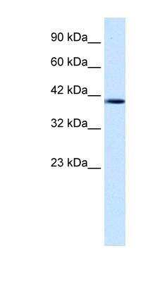 Western Blot: Nesfatin-1/Nucleobindin-2 Antibody [NBP1-57952]
