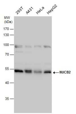 Western Blot: Nesfatin-1/Nucleobindin-2 Antibody [NBP3-12972]