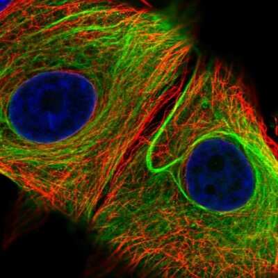Immunocytochemistry/ Immunofluorescence: Nesprin 2 Antibody [NBP2-38620]