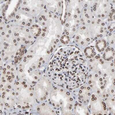 Immunohistochemistry-Paraffin: Nesprin 2 Antibody [NBP1-84190]