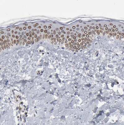 Immunohistochemistry-Paraffin: Nesprin 2 Antibody [NBP1-84190]