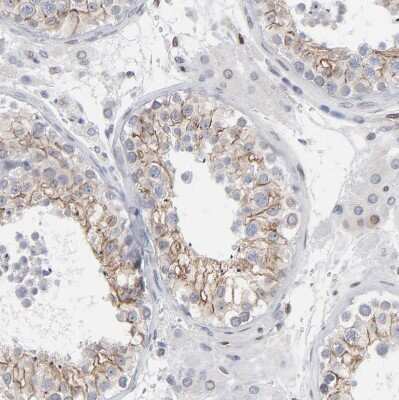 Immunohistochemistry-Paraffin: Nesprin 2 Antibody [NBP1-84190]
