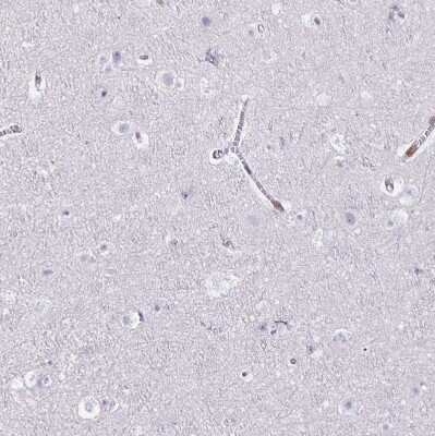 Immunohistochemistry-Paraffin: Nesprin 2 Antibody [NBP2-38620]
