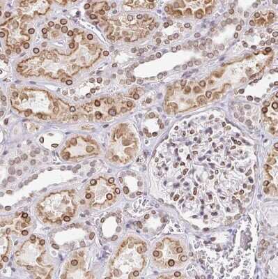 Immunohistochemistry-Paraffin: Nesprin 2 Antibody [NBP2-38620]