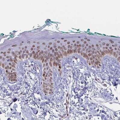 Immunohistochemistry-Paraffin: Nesprin 2 Antibody [NBP2-38620]