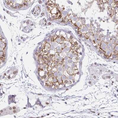 Immunohistochemistry-Paraffin: Nesprin 2 Antibody [NBP2-38620]