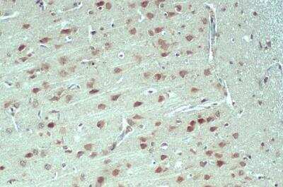 Immunohistochemistry-Paraffin: Nesprin 2 Antibody [NBP2-42886]