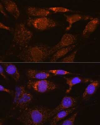 Immunocytochemistry/ Immunofluorescence: Nesprin-3 Antibody - Azide and BSA Free [NBP2-93890]