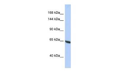 Western Blot: Nesprin-3 Antibody [NBP2-85375]