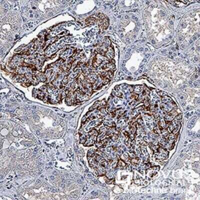 Immunocytochemistry: Nestin Antibody (10C2) - Azide and BSA Free [NBP2-80869]