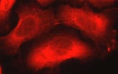 Immunocytochemistry/ Immunofluorescence: Nestin Antibody (10C2) - BSA Free [NB300-266]