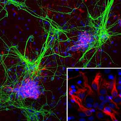 Immunocytochemistry/ Immunofluorescence: Nestin Antibody (4D11) [NBP1-92717]