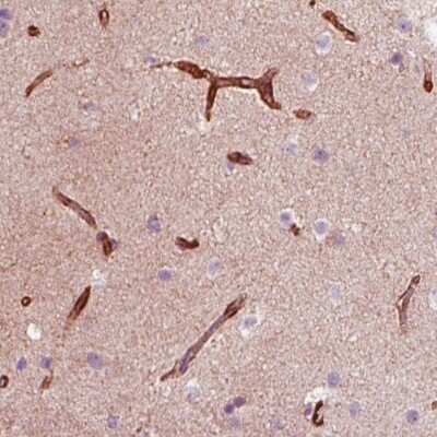 Immunohistochemistry-Paraffin: Nestin Antibody (CL0197) [NBP2-59775]