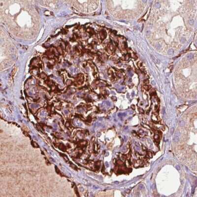 Immunohistochemistry-Paraffin: Nestin Antibody (CL0197) [NBP2-59775]