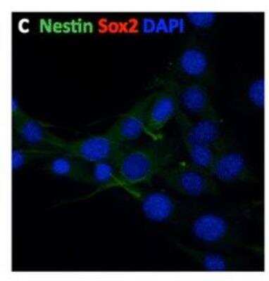 Immunocytochemistry/ Immunofluorescence: Nestin Antibody [NB100-1604]