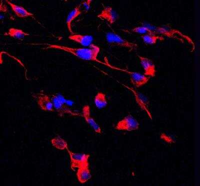 Immunohistochemistry-Frozen: Nestin Antibody [NB100-1604]