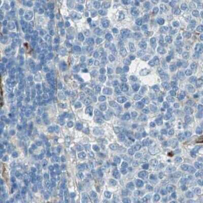 Immunohistochemistry-Paraffin: Nestin Antibody [NBP2-48504]