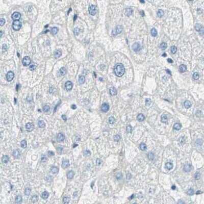 Immunohistochemistry-Paraffin: Nestin Antibody [NBP2-48504]