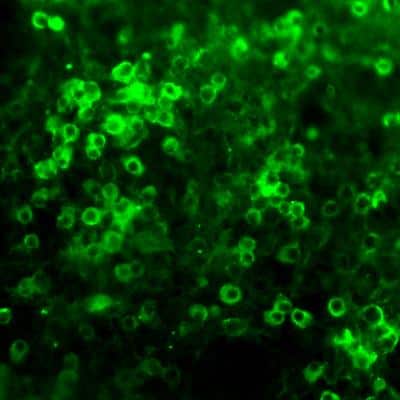Immunocytochemistry/ Immunofluorescence: Netrin-1 Antibody [NB100-1605]