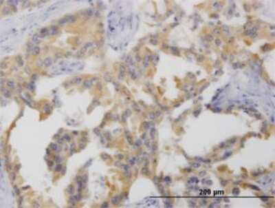 Immunohistochemistry-Paraffin: Netrin G2 Antibody (4F11) [H00084628-M01]