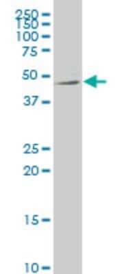Western Blot: Netrin G2 Antibody (4F11) [H00084628-M01]