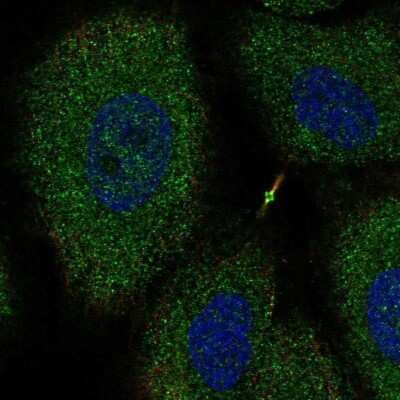 Immunocytochemistry/ Immunofluorescence: Netrin G2 Antibody [NBP2-68828]