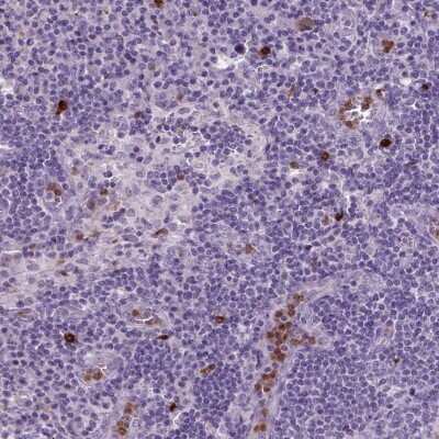 Immunohistochemistry: Netrin G2 Antibody [NBP2-49653]
