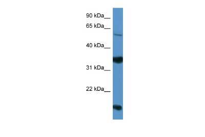 Western Blot: Netrin G2 Antibody [NBP3-09395]