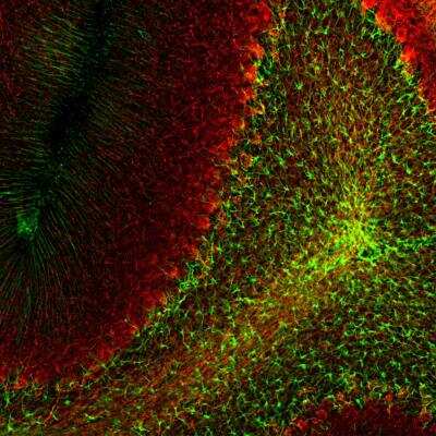 Immunohistochemistry Free-Floating: Neural Stem Cell Marker Antibody Pack [NBP1-42826]