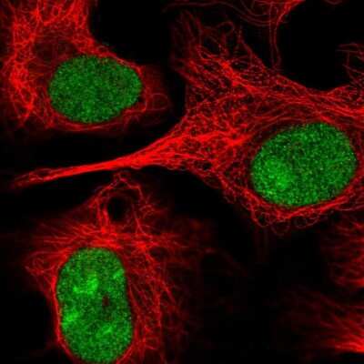 Immunocytochemistry/ Immunofluorescence: Neuregulin-2 Antibody [NBP2-57043]