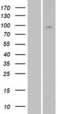 Western Blot: Neuregulin-2 Overexpression Lysate [NBP2-10339]