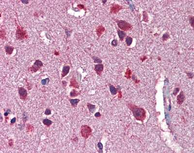 Immunohistochemistry-Paraffin: Neuregulin-3/NRG3 Antibody [NBP1-59338]