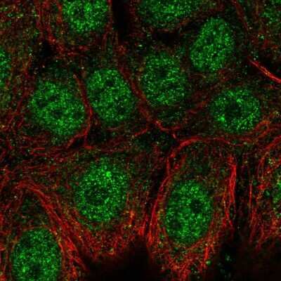 Immunocytochemistry/ Immunofluorescence: Neuro D4 Antibody [NBP2-13932]