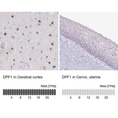 Immunohistochemistry-Paraffin: Neuro D4 Antibody [NBP2-13932]