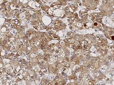 Immunohistochemistry-Paraffin: NeuroD1 Antibody [NBP2-98697]