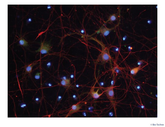 Rat Motor Neurons Express Motor Neuron-specific Markers and Form an Extensive Network of Neuronal Processes