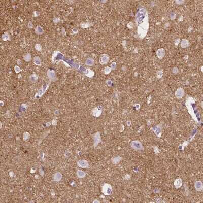Immunohistochemistry-Paraffin: Neurocan Antibody [NBP1-84368]