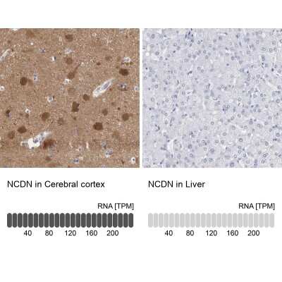 Immunohistochemistry-Paraffin: Neurochondrin Antibody [NBP1-87901]