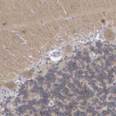 Immunohistochemistry-Paraffin: Neurochondrin Antibody [NBP1-87901]