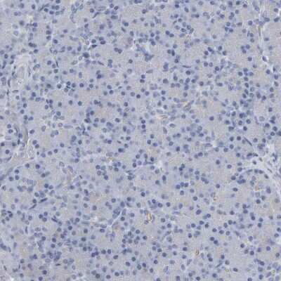 Immunohistochemistry-Paraffin: Neurochondrin Antibody [NBP1-87901]