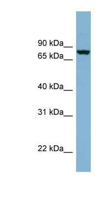 Western Blot: Neurochondrin Antibody [NBP1-55390]