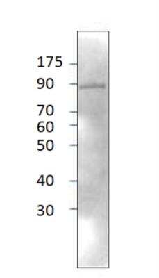 Western Blot: Neurochondrin Antibody [NBP1-60892]