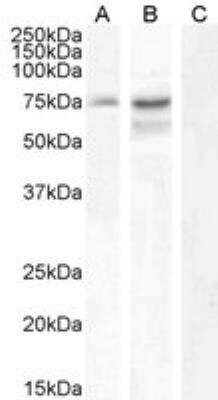 Western Blot: Neurochondrin Antibody [NBP2-75968]
