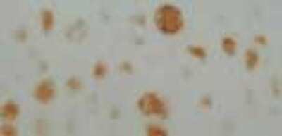 Immunohistochemistry: Neurofibromin 1 Antibody [NB300-155]